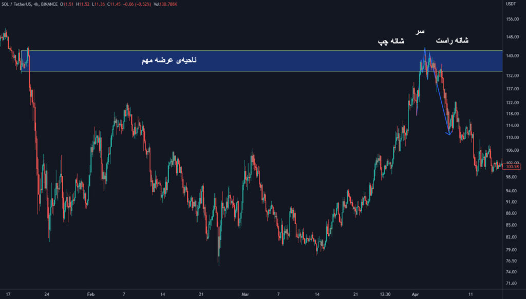 الگوی سر و شانه در سقف در ناحیه عرضه
